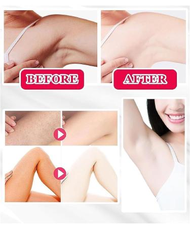 Brightening Cream for Underarms Armpits Knees Elbows Brightening Cream for Dark Spots Instant Dark Spot Corrector Cream for Underarms Whitening Cream - Buy Online on GoSupps.com