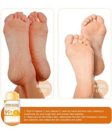 Hand Cream Rough Foot Care Cream Foot Cream For Cracked Heel Moisturizer Cream for Hand and Foot 40g Natural Nourishing Hand and Foot Care Cream Deep Hydrating & Smooth Dull Skin - Buy Online on GoSupps.com