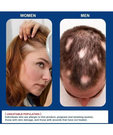 Alop cie Cr me De R paration Soin R parateur Cuir Chevelu Cheveux pais R duit La Perte De Cheveux Les Soins Du Cuir Chevelu(20gx2pcs) - Buy Online on GoSupps.com
