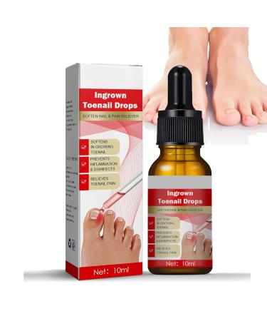 Ingrown Toenail Treatment Ingrowing Toenail Treatment Nail Growth Treatment Natural Ingrown Toenail Correction Nail Treatments Trimming Toenail Softening Drops Toe Nail Fungal Treatment(10ml)