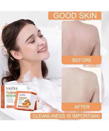 Natural Turmeric Soap Bar & Cleansing Pads - Handmade Face & Body Soap with 20 Facial Sponges | Smoother Skin for Men & Women - International Shipping - Buy Online on GoSupps.com