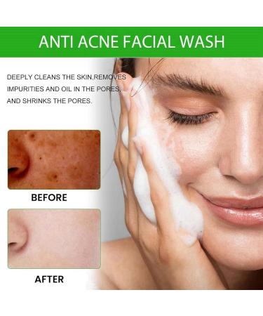 Squalane Cleanser Face Wash For Dry Skin Squalane Moisturising Cleanser Glycerin And Rich In Vitamins To Protect Skin Squalane Oil Remover Oil Based Cleanser Exfoliating Face Wash Cream Cleanser - Buy Online on GoSupps.com