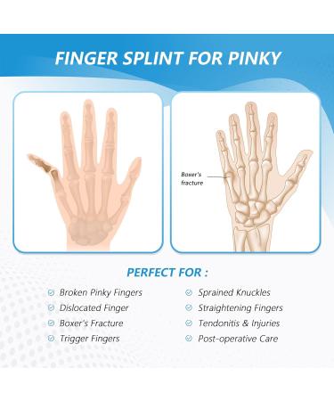 Joingood Adjustable Finger Rail for Boxer Fractures & Tendonal Inflammation - Small Pinky Support for Left & Right Hand - Buy Online on GoSupps.com