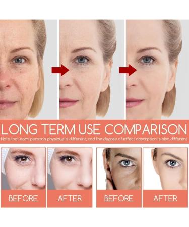 KOAHDE Squalane Deep Moisture Serum Squalane Dark Spot Corrector Serum Squalane Acne Reduce Serum Squalane Hydrating Serum Squalane Brighten Skin Serum Squalane Shrink Pores Facial Serum Collagen - Buy Online on GoSupps.com