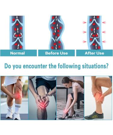 Buy KTINNEAD 20-30 mmHg Compression Pantyhose - Footless Medical Stockings for Women | Opaque Tights for Swelling Varicose Veins Edema - Perfect for Pregnancy & Professionals - Buy Online on GoSupps.com
