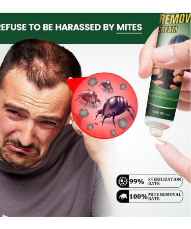  MagiSel Deep Cleansing Cream Scalp Exfoliating Scalp Gentle Care for Itchy Dandruff Hair Care Gentle Moisturizing Moisturizing 30g - Buy Online on GoSupps.com