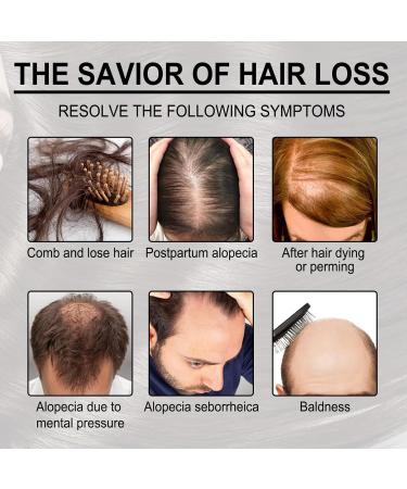 Rosemary Oil for Hair Hair Regrowth Serum Relieve Dry Damaged Hair to Target Hair Loss Rosemary Hair Serum for Hair Rapid Growth and Thickening Trengthen Hair Roots - Buy Online on GoSupps.com