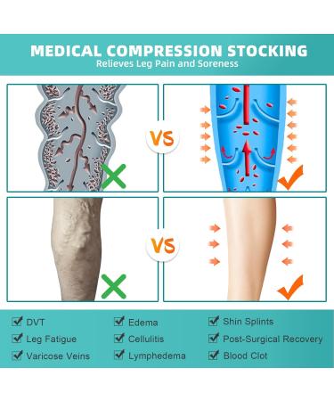 Evolyline 2 Pairs Medical Compression Stockings for Men & Women | 20-30 mmHg Thigh High Support Socks for Varicose Veins | XXL Black & Beige - Buy Online on GoSupps.com