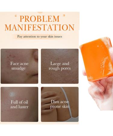 Skin Brightening Soap - Kojic Acid Soap for Dark Spots - Face Cleanser Soap - Dark Spot Remover Soap Bar - Clean Skin Oil Antioxidant Moisture - Skincare Beauty Product for All Type Skin - Buy Online on GoSupps.com