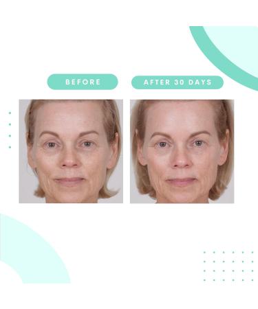 Serious Skincare Glycolic Gommage Extreme Renewal Facial Mask - Micro Exfoliation for Radiant Skin & Decongest Pores - 4.5 oz - Buy Online on GoSupps.com