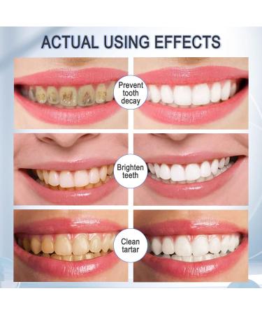 Foam Toothpaste Whitening & Deep Cleaning with Baking Soda | Ultra-fine Mousse for Optimal Oral Care - Buy Online on GoSupps.com