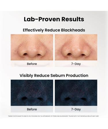 ConfidMiss Glow Exfoliating Serum Face Peeling with Glycolic & Salicylic Acid Blackhead Remover Gentle Exfoliator Pore Refining AHA BHA PHA for Oily Skin Women & Mens - Buy Online on GoSupps.com