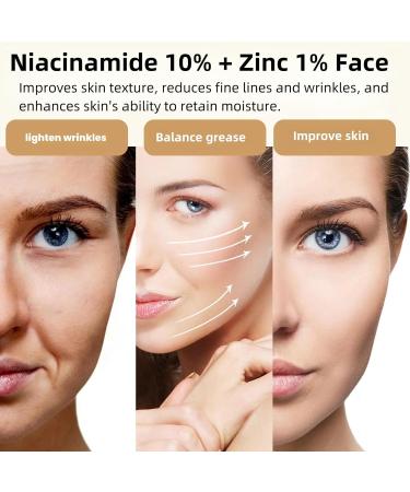 10% Niacinamide + 1% Zinc Face Serum - Nourishing & Refreshing for Oil Control & Acne | 30ML - Buy Online on GoSupps.com