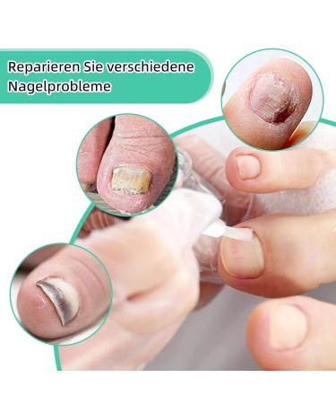 Nail Care Pen - Health Nail Care Routine for Clean Whiten & Repair | 3 Pack - Buy Online on GoSupps.com