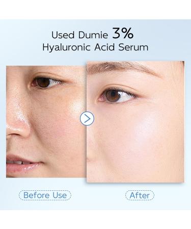 3% Hyaluronic Acid Serum for Face Anti-Aging Hydrating Serum with 20 000 ppm Ceramide NP & 10 000ppm Acetyl Hexapeptide-8 Korean Skincare ultra hydrating serum turm Skin/Sensitive Skin(1.5 ml*30) 1.52 Fl Oz (Pack of 1) - Buy Online on GoSupps.com