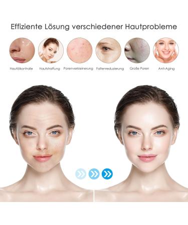  Bestauty Dr. pen Ultima M8/M7S 10 Pack Nano-S Cartridges for Eye Care Skin Redness Thin Layer Corneum and Sensitive Skin - Genuine Dr pen Ultima M8/M7S Cartridges (10 Pack Nano-S for - Buy Online on GoSupps.com