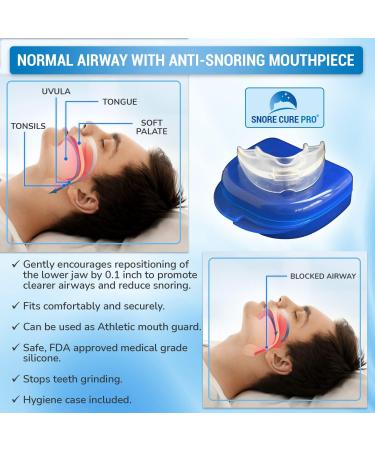 Premium Anti Snore Devices Kit | Mouth Guard, Nasal Strips, Nose Vents, Clips, Ear Plugs + Hypnosis Recording & Ebook | Stop Snoring Aids for Men & Women - Buy Online on GoSupps.com