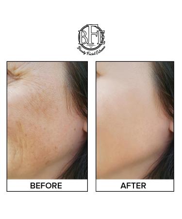 Anti-Aging Exfoliating Peel Pads | Lactic Salicylic & Glycolic Treatment for Fine Lines Wrinkles & Dark Spots | Face & Body Care - Buy Online on GoSupps.com