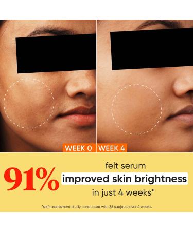 Vitamin C + E 5% Niacinamide Serum | Vitamin C Serum For Glowing Skin | Fades Dark Spots | Vit C Serum with Blood Orange & Pumpkin | For Uneven & Dull Skin | For All Skin Types | 30ml - Buy Online on GoSupps.com