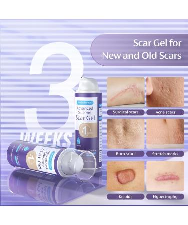 Skiennix 50g/1.76oz Advanced Scar Cream Gel - Medical Grade Silicone for Surgical Scars, Stretch Marks, Acne, Burns & Keloids - Effective Treatment for Old & New Scars - Buy Online on GoSupps.com