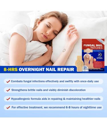 Patchs pour les Mycoses des Ongles (21 pi ces) Traitement et R paration des Mycoses des Ongles des Pieds Multi-usages pour les Ongles pais Fissur s et D color s Soin et R paration des Ongles Ab m - Buy Online on GoSupps.com