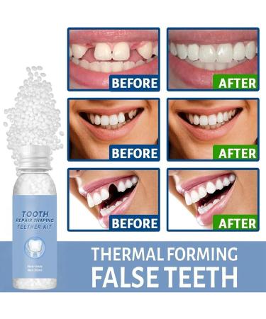 Temporary Tooth Repair Kit | Modable False Teeth & Filler Granules | Fake Teeth & Missing Tooth Fix | Dental Repair Beads - Buy Online on GoSupps.com