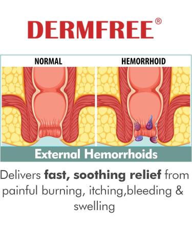 Hemorrhoid Ointment Care Instantly Relieves Swelling Pain Itching Burning and External Discomfort Helps to Protect Irritated Tissue 1.5Oz (1.5 Oz (Pack of 1) 1.5 Ounce (Pack of 1) - Buy Online on GoSupps.com