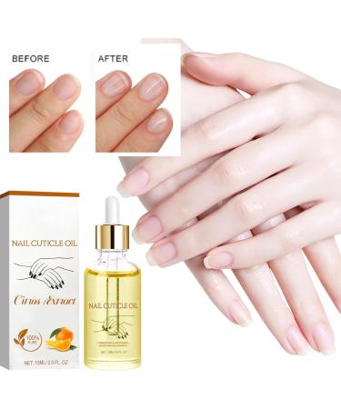 Cuticle Oil for Nails Nail Oil Cuticle with Vitamin E Soothe Moisturize Nail Cuticle Oil Moisturizes Cuticle and Nail's Skin Strengthens Nails Prevents Hangnails and Chapped 15ML - Buy Online on GoSupps.com