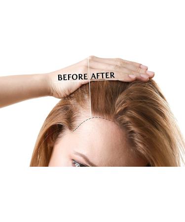 100% Pure Vitamin E Oil 75,000 IU - 8 oz | Skin, Hair, Nails, Body Care | Full Spectrum D-Alpha Tocopherol | Hydrating & Rejuvenating Antioxidant - Buy Online on GoSupps.com