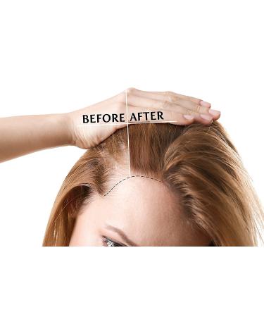 Pure Castor Oil - 8 oz w/Dispense Cap - Pure Natural Non-GMO Hexane-Free Vegan Carrier Oil - Promotes Hair Growth Conditions - Skin Hair Lashes Brows Cuticles & More - Buy Online on GoSupps.com