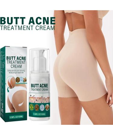  Uzionoie Butt Acne Cream Cream to Remove Acne on Buttocks Reduces Butt Pimples Restores Soft and Smooth Butt Skin 100ml - Buy Online on GoSupps.com
