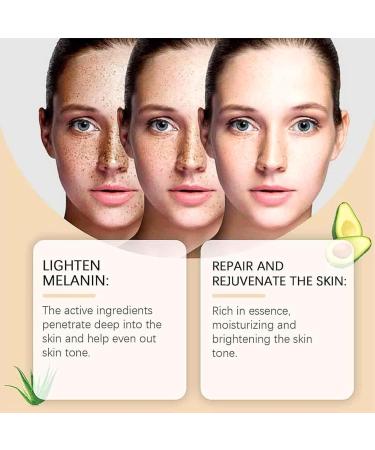 Melanin Correcting Cream Spot Cream For Melanin Correcting Melanin Correcting Body Cream Freckle Removal Cream Dark Spot Remover For Face Dark Spot Corrector Stick For Body Knees Neck Armpit - Buy Online on GoSupps.com
