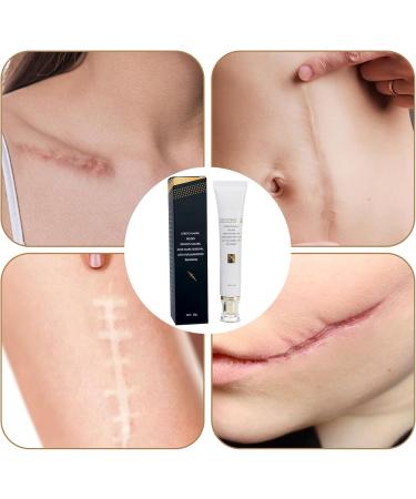  G n rique Body Scar Cream | 30g Non-Greasy Moisturizer - Smoothing Cream for Skin and Scars for Cheeks Arms Hands Neck Teenagers Adults Women Men and Seniors - Buy Online on GoSupps.com