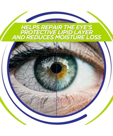Optrex ActiMist Tired and Strained Eyes - Fast Relief for Fatigued Eyes - Buy Online on GoSupps.com