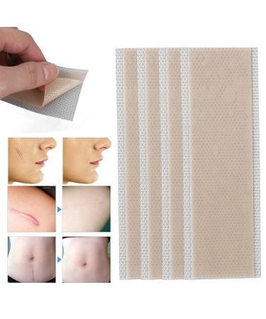 Portable Waterproof Silicone Scar Sheets - 4pcs | Scar Removal Treatment | Breathable & Reusable | Stomach Pads for Men & Women - Buy Online on GoSupps.com