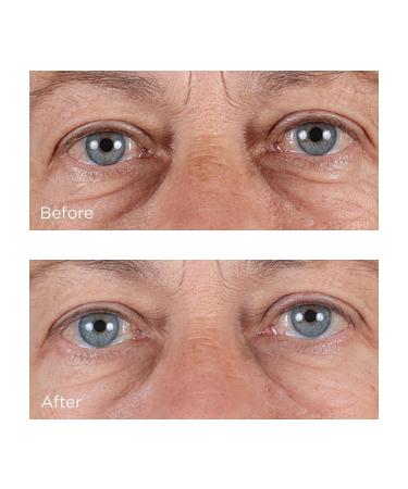 Perricone MD Hyaluronic Intensive Hydrating Serum - 2 fl. oz - Buy Online on GoSupps.com