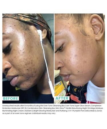 Urban Skin Rx Reti-Glow Night Oil | Bakuchiol & Vitamin E, Retinol-Alternative for Skin Resurfacing & Smoothing | 0.5 Oz - Buy Online on GoSupps.com