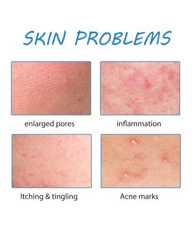 Micro Infusion System & Glamroom Serum - Smooth Skin Facial Solutions for All Skin Types | International Shipping - Buy Online on GoSupps.com