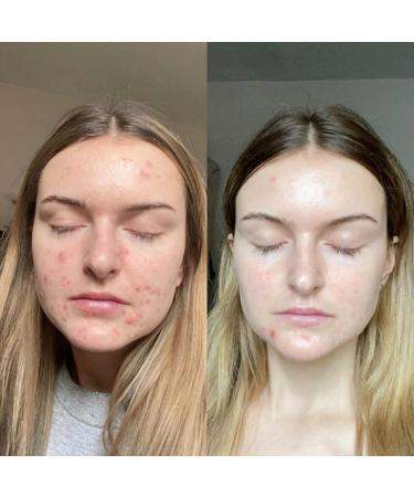 Retinol Gel 0.1 Vitamin A Repairs Fine Lines & Wrinkles Scar Treatment Age and Sun Spots Anti-Aging Formula Gel 20 Grams - Buy Online on GoSupps.com