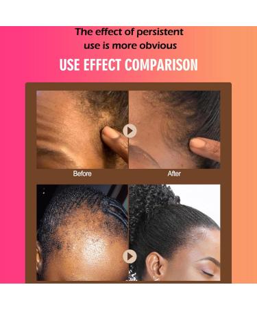  Zankie 1/3 Batana Oil for Hair Growth - 40ml - Batana Oil for Dry and Nourishing Hair - Leave-In Repair Oil - Hair Root Straightening Oil for - Buy Online on GoSupps.com