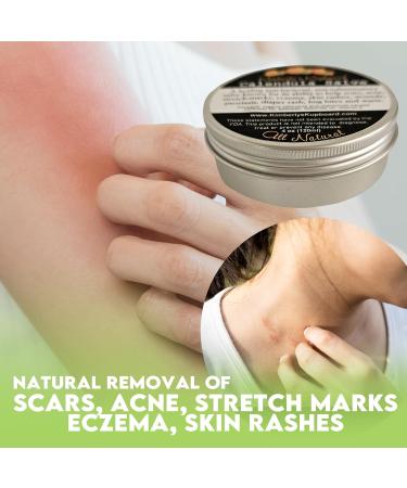 Kimberlys Kupboard Calendula Super Salve 112ml - Natural Herbal Balm for Dry Skin Bug Bites & Itch Relief - Chemical-Free Multipurpose Soothing Solution - Buy Online on GoSupps.com