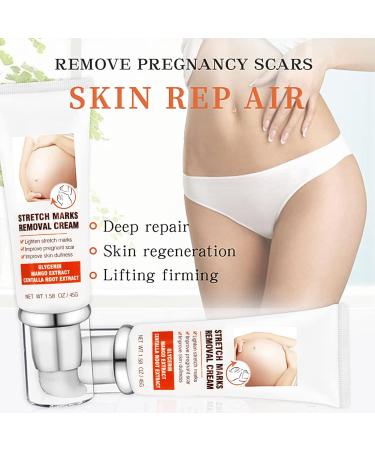 Remove Stretch Marks Cream | Body Repair Cream with Centella Glycerol for Women | Post-Pregnancy Stretch Mark Reduction | 45g - Buy Online on GoSupps.com