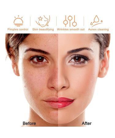 Beauty Star Portable Handheld Skin Care Device for Face and Hair - Daily Use - Buy Online on GoSupps.com