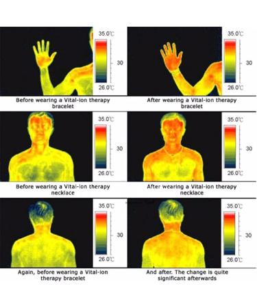 NBZZ Lymphdrainage Magnetic Bracelet - Exquisite Energy Health Bracelets for Arthritis | Perfect Mother's Day Gift - 4PCs - Buy Online on GoSupps.com