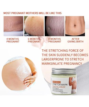 Belly Mark Cream Pregnancy Stretch Mark Lotion Fast Absorbing Formula Smoothing Skin Solution 100g Tube Hydration Excellent for Travel Business Trips Home Use - Buy Online on GoSupps.com
