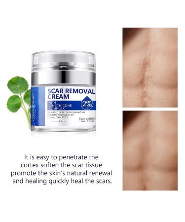 50ml Skin Repair Stretch Mark & Scar Removal Cream - Effective Surgery, Injury & C-Section Scar Lightening Treatment & Toenail Clippers Removal Solution - Buy Online on GoSupps.com