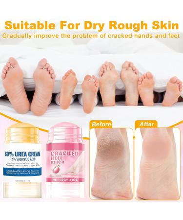 Ruichi Cr me l'Ur e 60% Creme Pour les Pied Creme Pieds Tres Secs et Abimes Cr me Pieds R paratrice Hydratante Crevasse pour Les Pied-s a L'ur e Tr s S cs Ab m s a 10 g (Lot de 1) - Buy Online on GoSupps.com