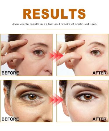 Collagen Anti-Wrinkle Essence Dilutes Spots Moisturizes and Repairs Skin Barrier 1 count (Pack of 1) - Buy Online on GoSupps.com