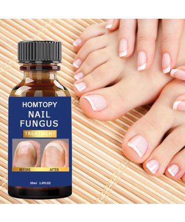 R paration des ongles | Renforcement des ongles pour ongles fins et croissance | Solution de r paration des ongles Renewal pour ongles d color s et ab m s Artiby - Buy Online on GoSupps.com
