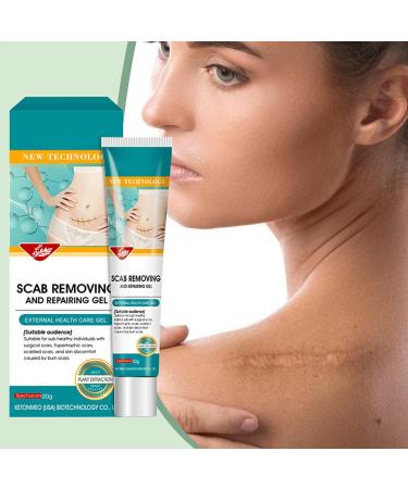  Pruojhw Anti-Scar Gel | 20g Treatment Gel for Wounds Long-Term Care for Scars - For Comfort Recovery Burn Protection and Injury Protection for Home and Body - Buy Online on GoSupps.com